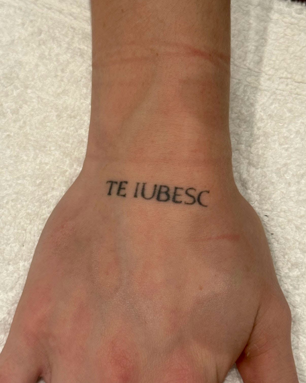 Tattoo Removal — Before