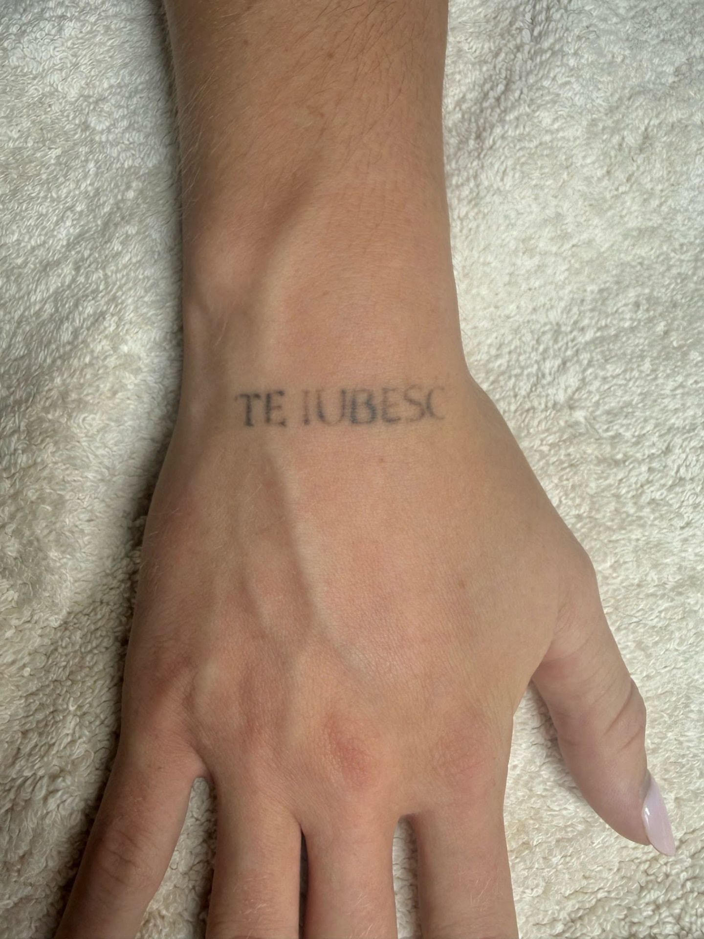 Tattoo Removal — After a course of sessions